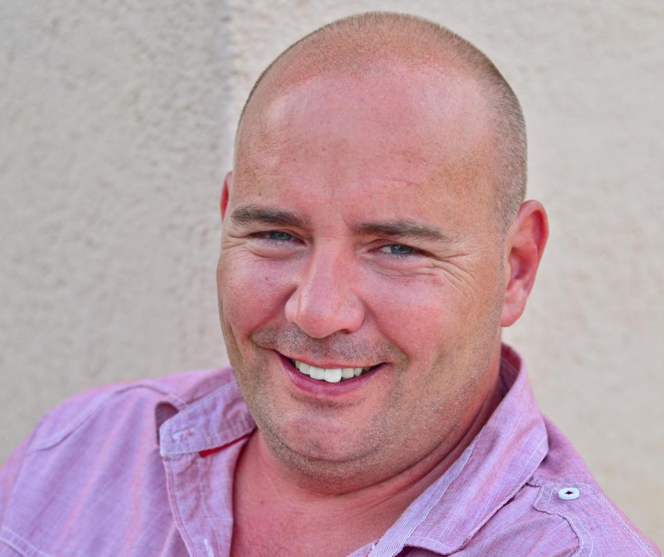 Male pattern baldness can have a significant affect on hairline shape.