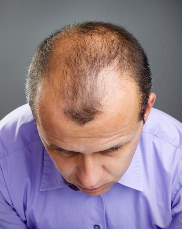 Thinning hair might benefit from a volumizing hair spray.