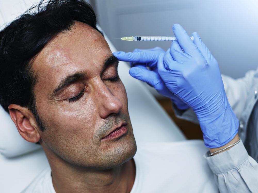 Botox injections paralyze the face's muscles, reducing the appearance of wrinkles such as crow's feet.