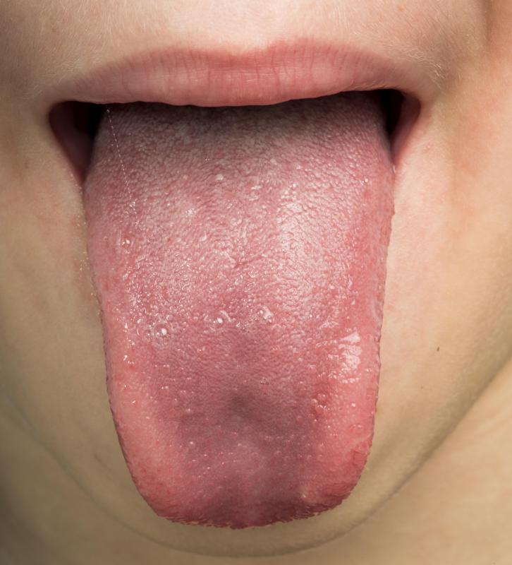 Warning signs of an allergic reaction may include a swollen tongue.
