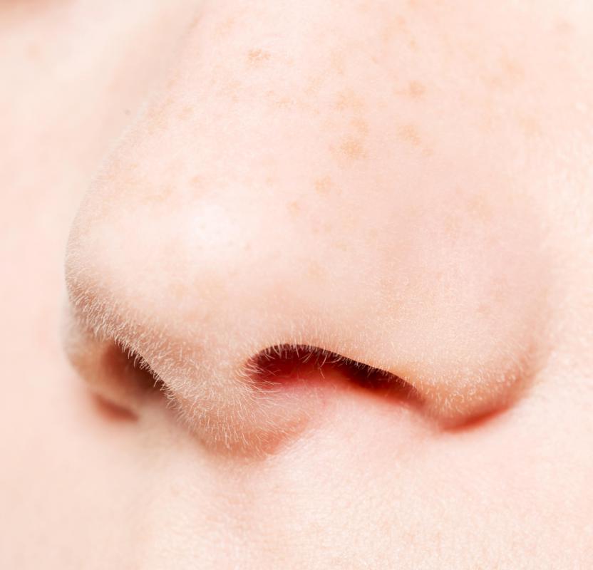 Hand sanitizer may help prevent the spread of MRSA, which most often lives in the nasal cavity.