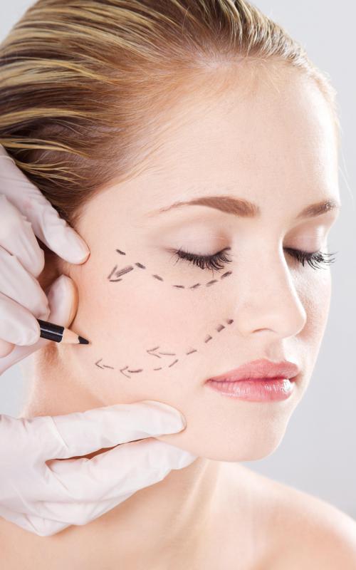 A woman preparing to get cheek augmentation.