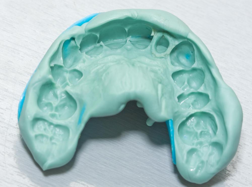 A dental impression is made to create dentures.