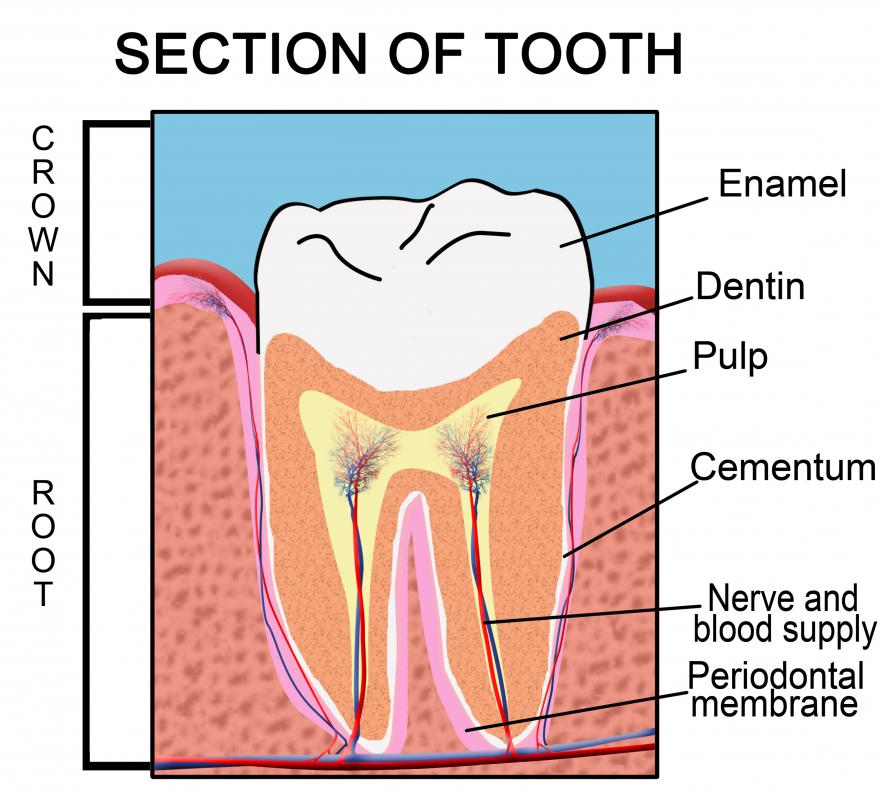 A remineralizing toothpaste may help repair tooth enamel.