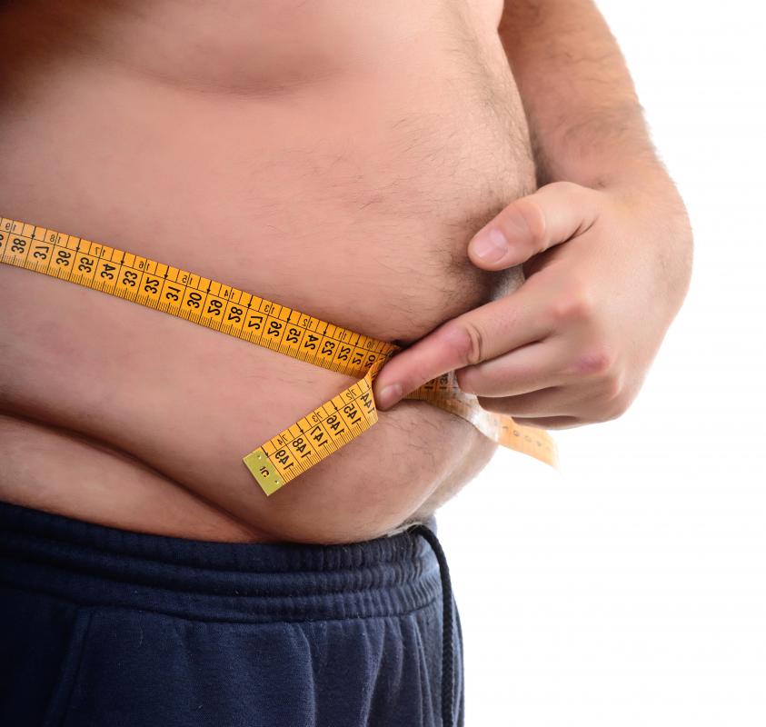People who are obese may remove a large portion of their excess fat through liposuction.