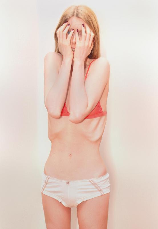 The perception of beauty in society can cause issues like eating disorders.