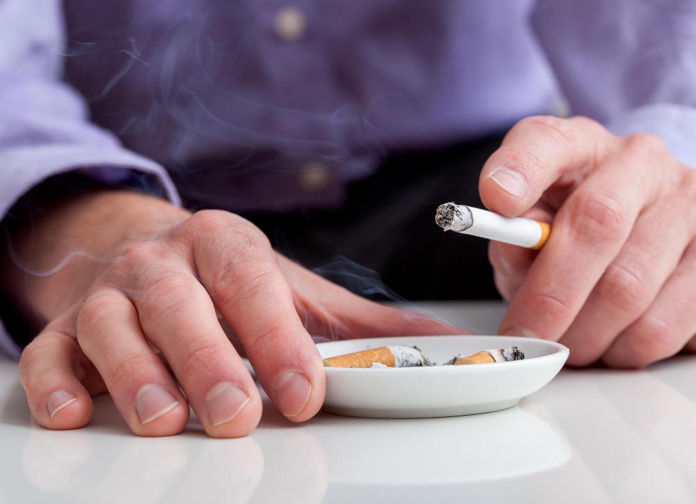 Patients who smoke or have been exposed to secondhand smoke are typically not good candidates for genioplasty surgery.