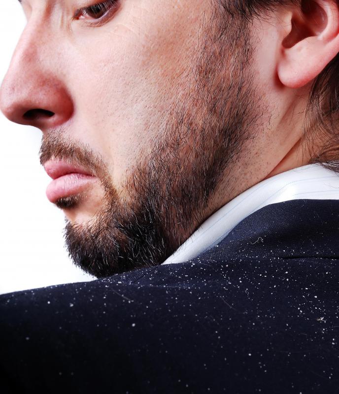 Signs of dandruff include an itchy scalp and white flakes that fall from the head.