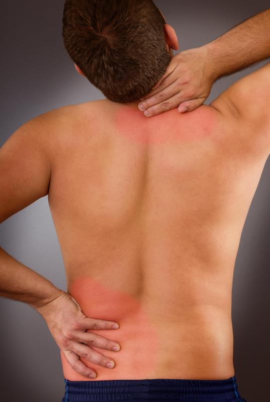 Chicken collagen may be useful in treating back and neck pain.