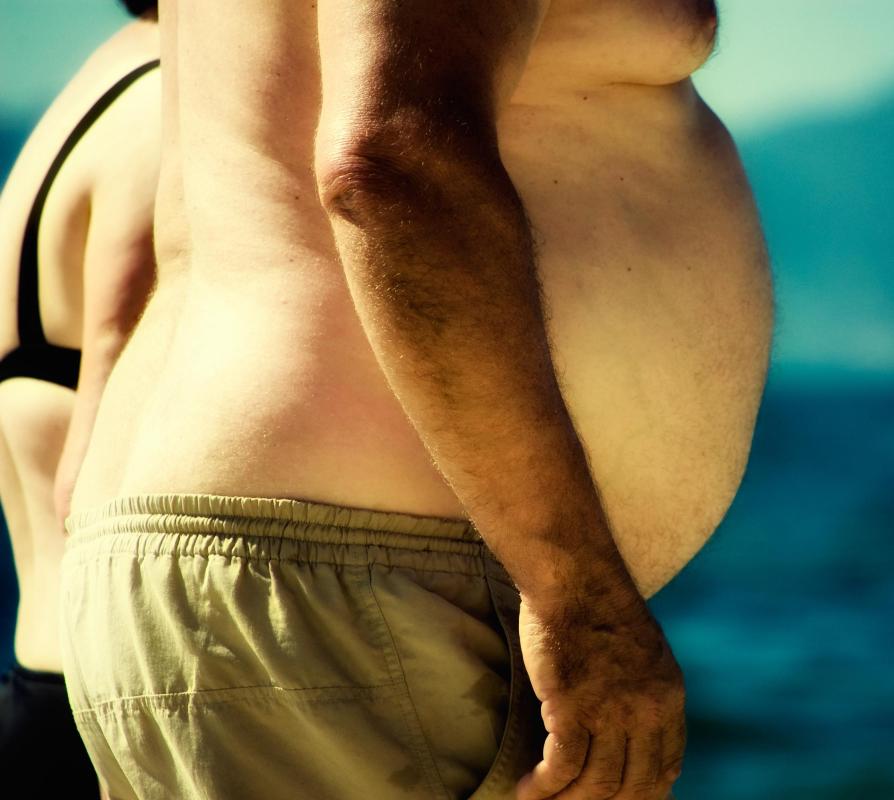 Dark groin skin may be caused by elevated insulin levels that are commonly seen in obese individuals and Type II diabetics.