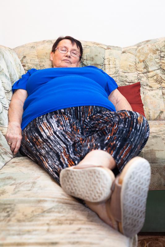 Obese individuals are often prone to stretch marks and other scarring.