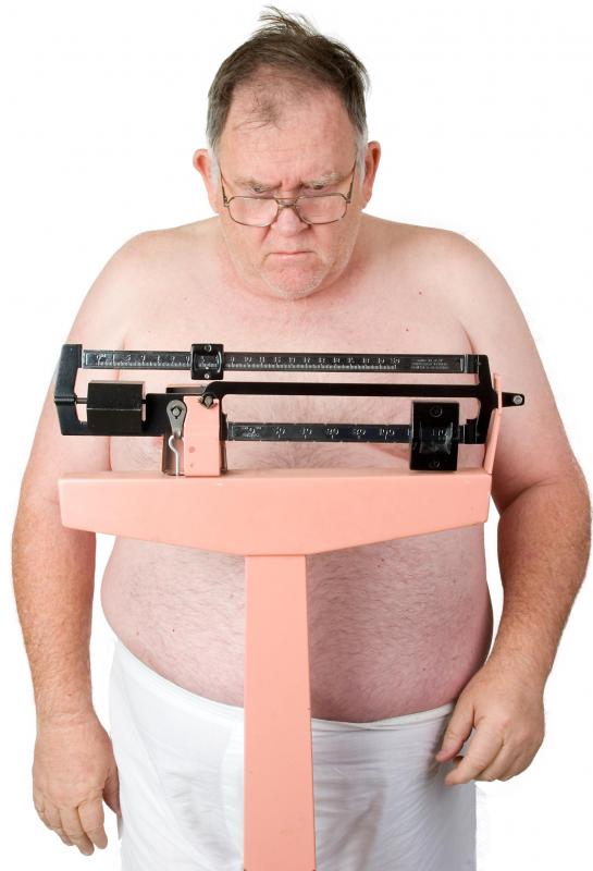 No amount of diet and exercise will improve a hereditary double chin.