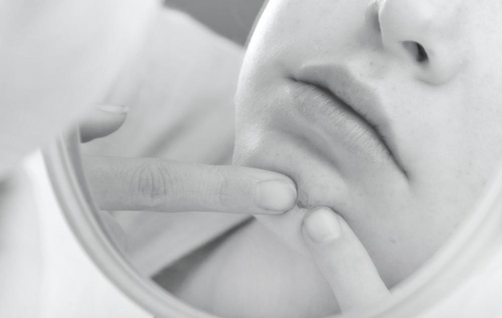 Certain face serums are formulated to fight acne.