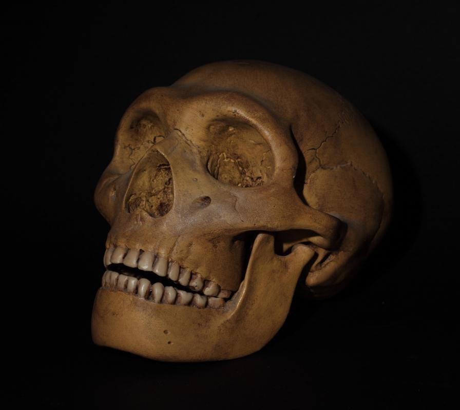 Wisdom teeth may exist because either tooth loss was more common in the past or jaws were larger.
