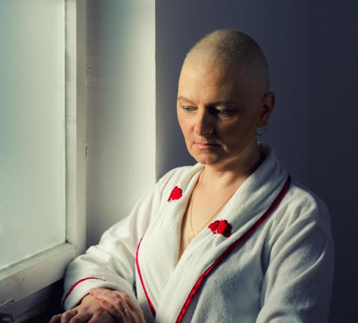 Hair loss often occurs as a side effect of chemotherapy.