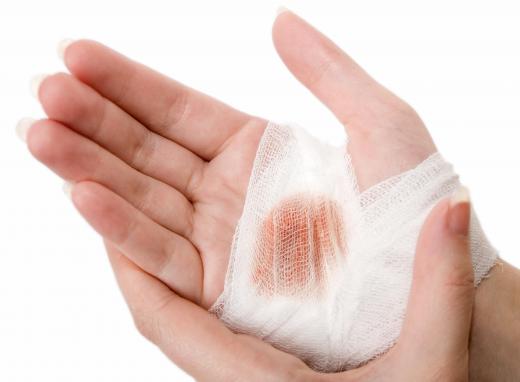 Hand salves may help treat cuts and scrapes.