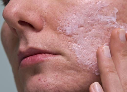 People who rely on retinol lotions and creams to fight cellulite's appearance may be required to keep using the products.