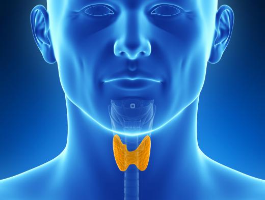 Hyperthyroidism can cause sudden and significant hair loss.