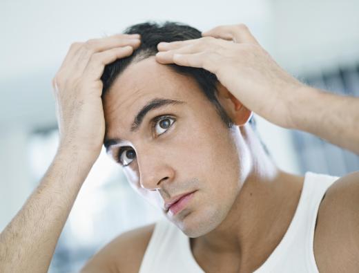 There are a number of disorders and conditions that can cause patchy hair loss.