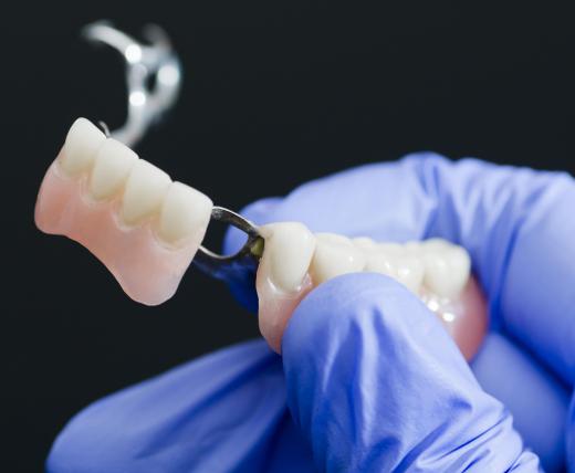 Many partial dentures and removable dental bridges can be brushed in the same way as natural teeth.