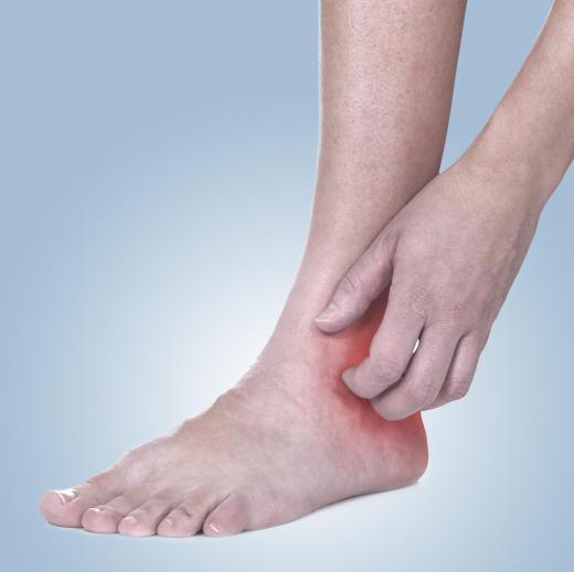 Regular washing can be used to treat a foot that's itchy or has a rash.