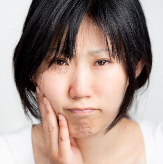 When wisdom teeth become impacted, they are typically removed.