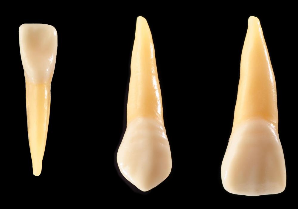 By about age 13, most of a person's adult teeth have come out.