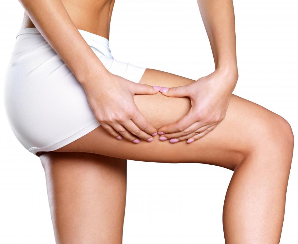 Laser liposuction generally relies on heat from laser lights to dissolve fatty tissue under the skin.
