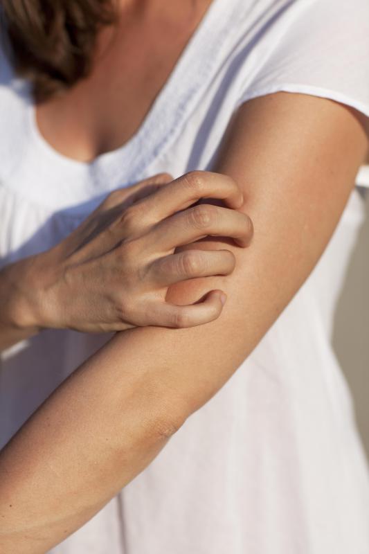Hypoallergenic products prevent an allergic reaction that can cause the skin to become itchy.