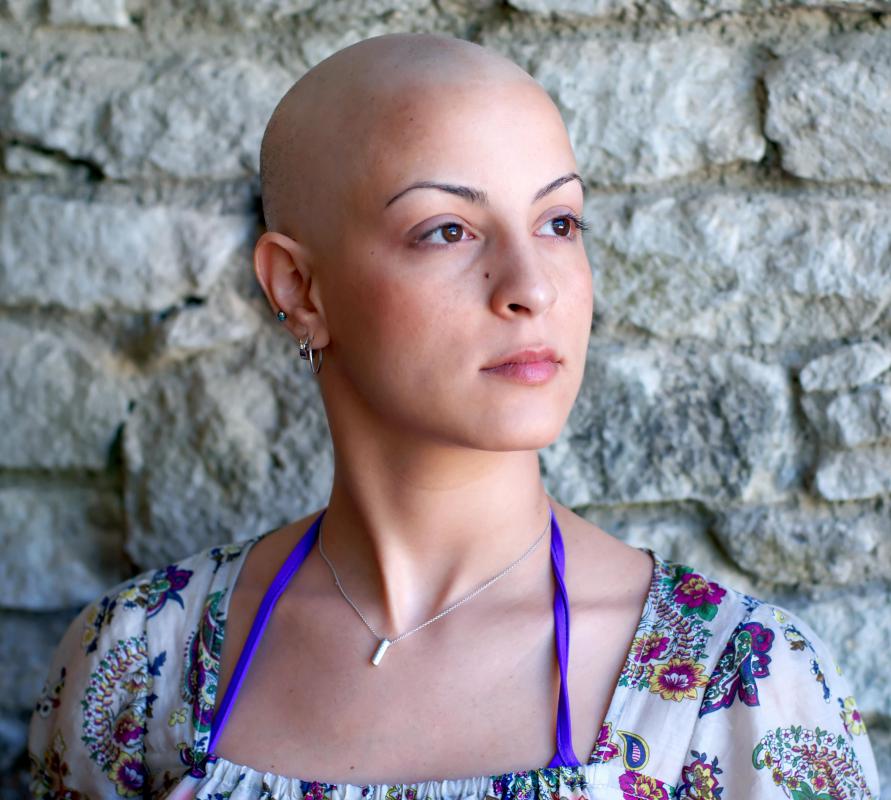 Those undergoing chemotherapy may experience bald spots quickly followed by a complete loss of hair.