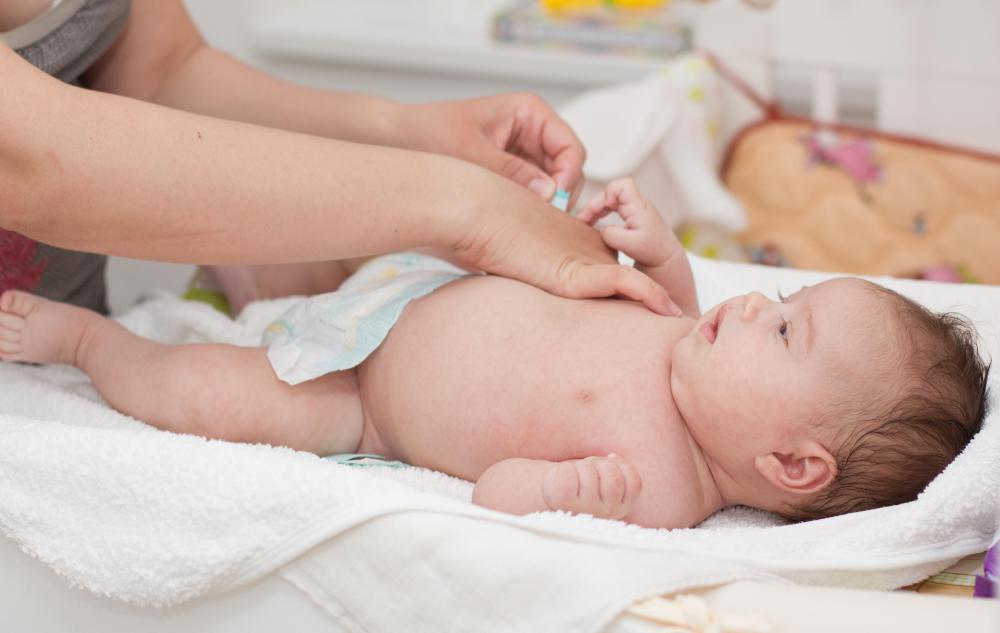 What are Cotton Balls? (with pictures)