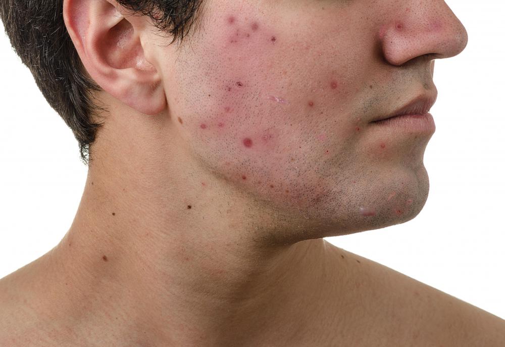 What Are the Characteristics of Light Olive Skin?