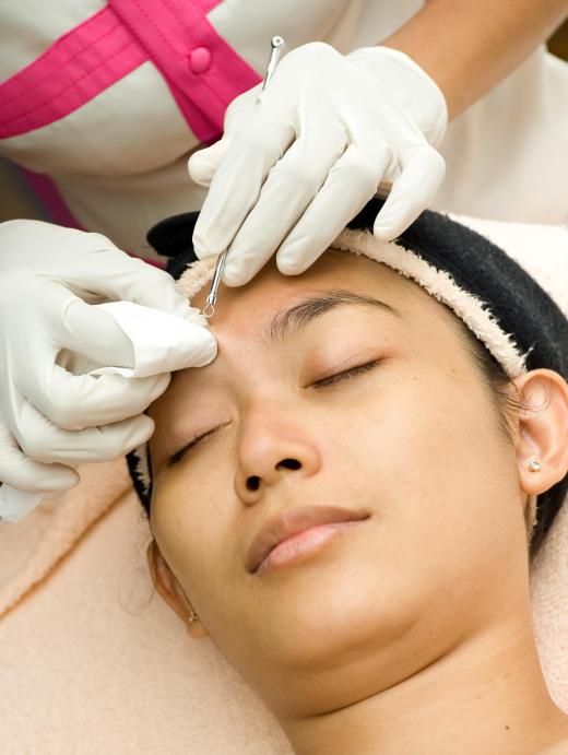 A comedone extractor is used to remove blemishes.