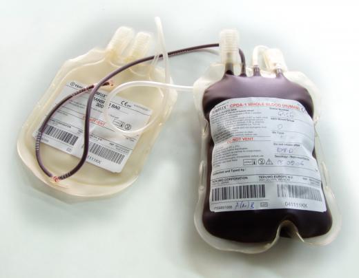 One empty and one full pint-sized blood bag.