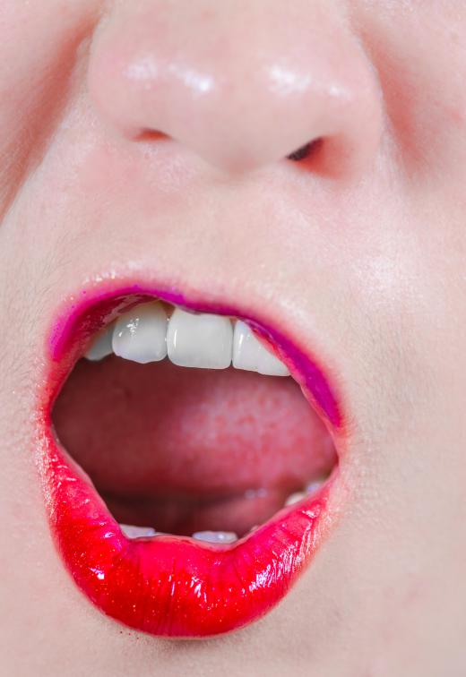 Using mouthwash can sometimes prevent fungus build-up in the mouth.