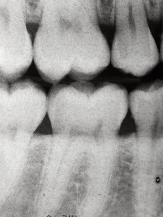 Dental X-ray.