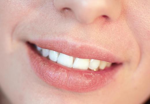 Beeswax ointment can help with chapped lips.