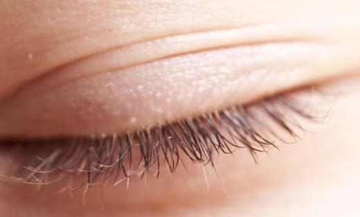 There are beauty treatment products that aim to thicken and lengthen eyelashes.