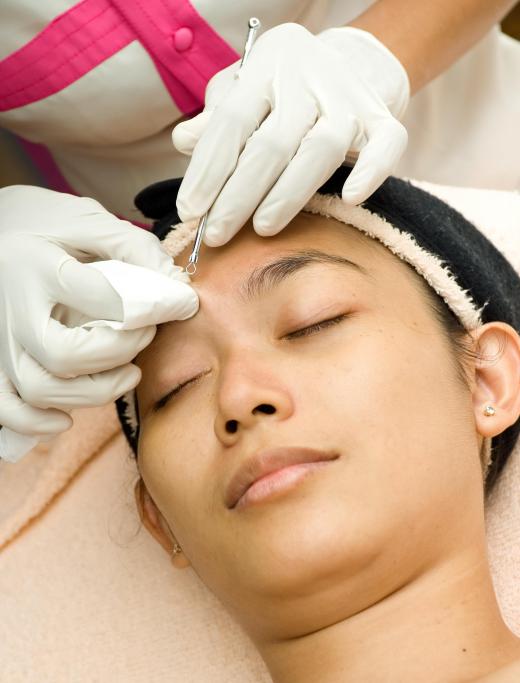 Metal loop extractors are sometimes used on clogged pores.