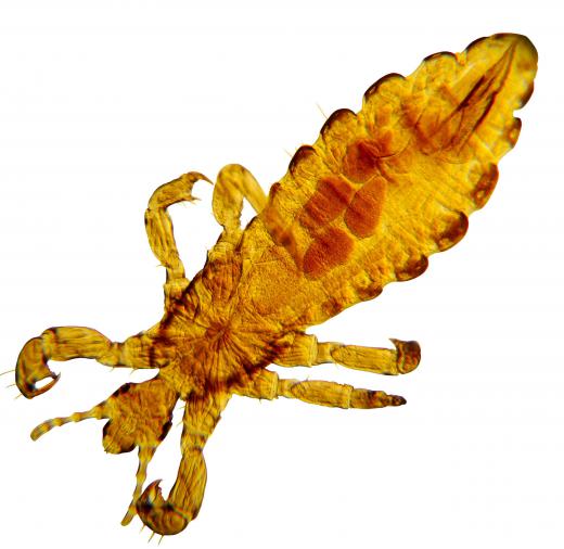 A head louse, which can be removed with medicated shampoo.