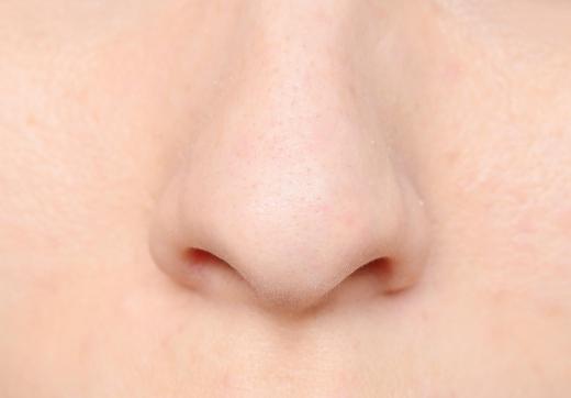 Acne cream may be used to treat nose pimples.