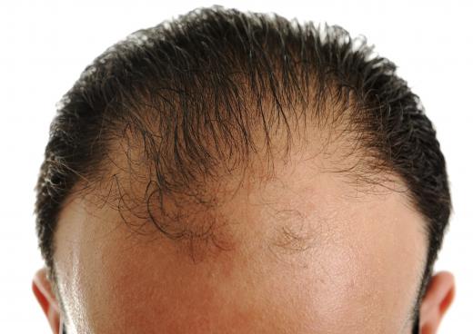 The increase of circulation caused by scalp massages can improve hair follicle growth and lead to more or newer hair.