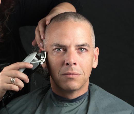 A buzz cut is an option for some men with thinning hair.