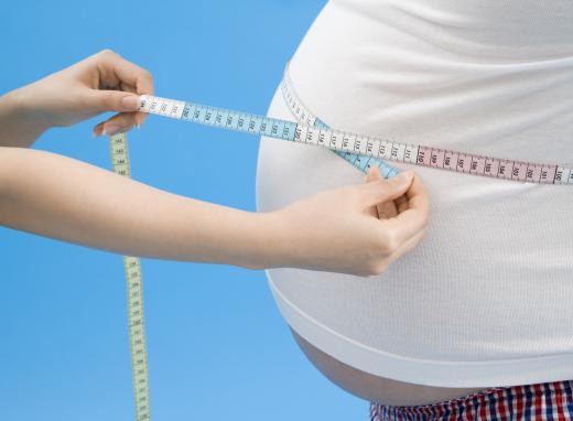 Striae are often seen in obese people who have gained weight at a rapid pace.