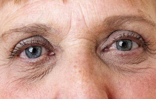 Plumping cream may help cover up wrinkles around the eyes in particular.