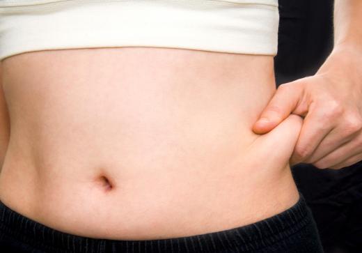 There are several surgical techniques that can be used in stomach liposuction.