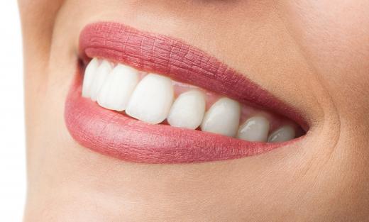 Whitening cosmetics may be used to whiten teeth.