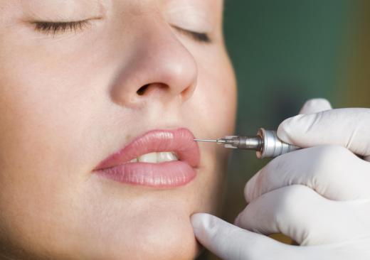 Cosmetic tattooing might be a permanent way to get rid of dark lips.