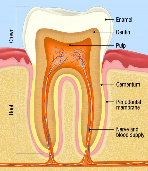 The high acid content in soft drinks dissolves the tooth's enamel.