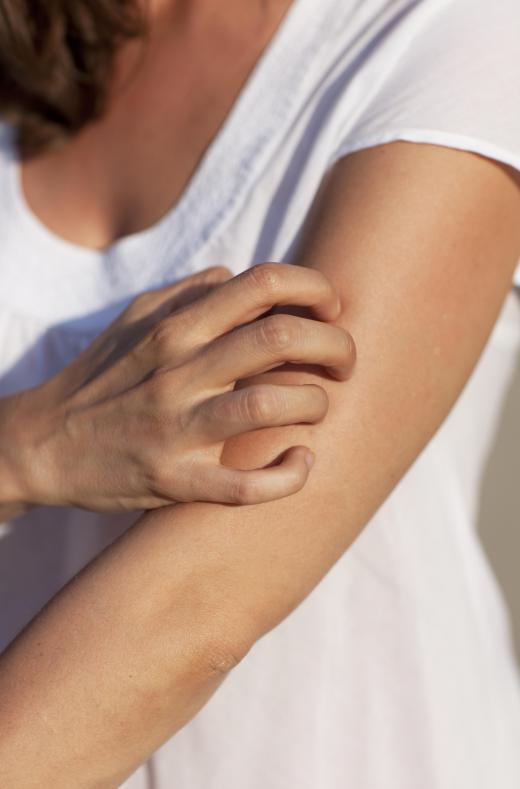 Oatmeal soap may be used to relieve skin itchiness.